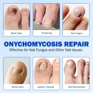 NESLEMY® Nail Fungus Care Patches