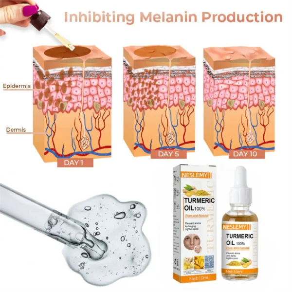 (🔥LAST DAY SALE-80% OFF)-Fast Dark Spot Remover-NESLEMY™  Turmeric Spot Repair Serum