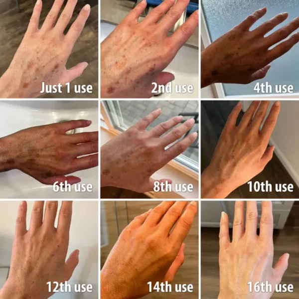 (🔥LAST DAY SALE-80% OFF)-Fast Dark Spot Remover-NESLEMY™  Turmeric Spot Repair Serum