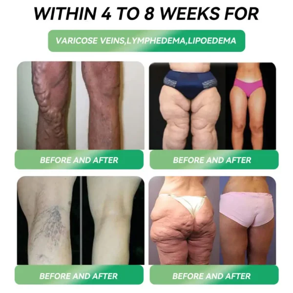 ✨Melt Fat & Balance Blood Sugar in 24H, Pain-Free!--NESLEMY™SMGT-GLP-1 Nano Microneedle Patc  💪✨