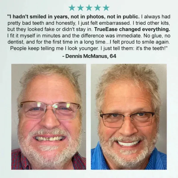 NESLEMY™🦷 𝗔𝗱𝘃𝗮𝗻𝗰𝗲𝗱 𝗖𝘂𝘀𝘁𝗼𝗺𝗶𝘇𝗲𝗱 𝗙𝘂𝗹𝗹 𝗗𝗲𝗻𝘁𝘂𝗿𝗲 𝗦𝗲𝘁 🦷 (Clinically backed comfort-fit dentures — trusted by over 8,000 users across the U.S.)