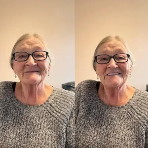 🦷NESLEMY™🦷 Natural Fit Full Denture Set（✅ Clinically backed comfort-fit dentures — Trusted for all-day comfort.）