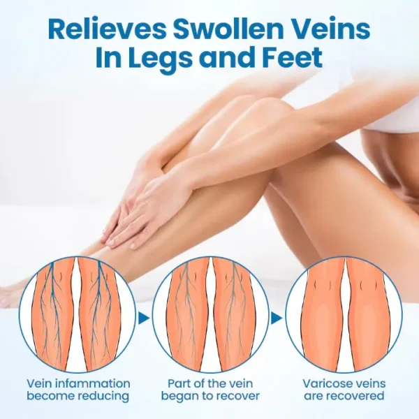 NESLEMY® VeinGuard Herbal Spray-✅ Clinically proven to eliminate varicose veins in just 7 days!