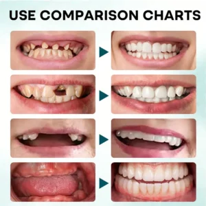 💖💖Limited-time offer: 60% off💖 NESLEMY® Firm Hold Denture Adhesive