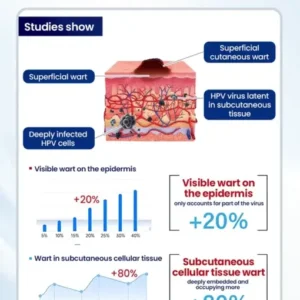 NESLEMY® ChillErase Bump Renewal Spray
