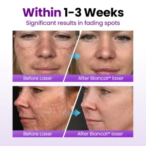 NESLEMY® SpotErase Probiotic Shield Serum