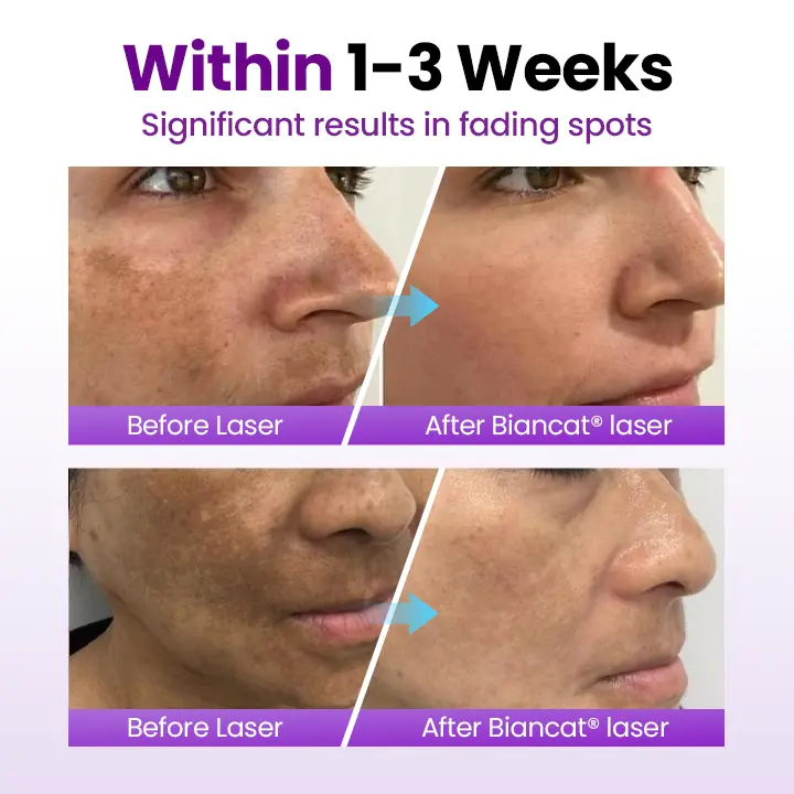 NESLEMY® SpotErase Probiotic Shield Serum