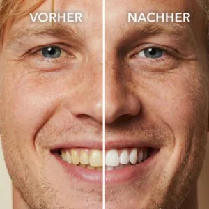 NESLEMY™ Tooth Polisher — Instantly Whiter Smile🦷