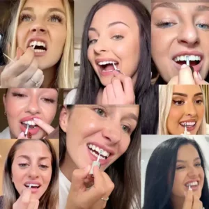 NESLEMY™ Tooth Polisher — Instantly Whiter Smile🦷