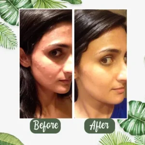 🎁Limited-time offer: 55% off🎁 NESLEMY™  100% Natural Green Tea Deep Cleanse Mask💖