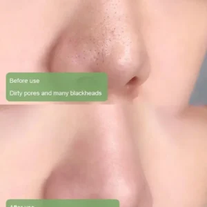 🎁Limited-time offer: 55% off🎁 NESLEMY™  100% Natural Green Tea Deep Cleanse Mask💖