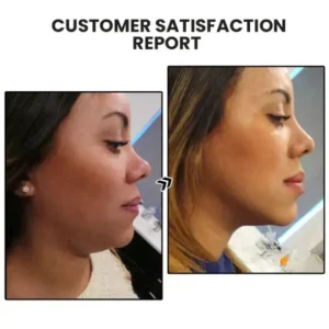 ✨NESLEMY Lymphatic MagneTherapy Germanium Earrings