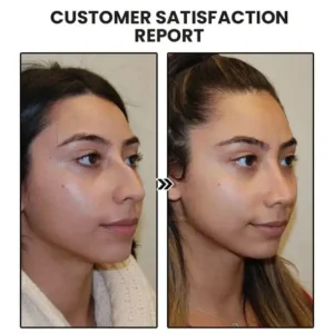 ✨NESLEMY Lymphatic MagneTherapy Germanium Earrings