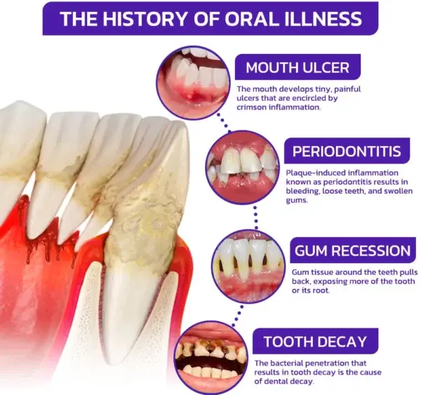 Rolimey® VioCore Bee Venom Dental Treatment Toothpaste