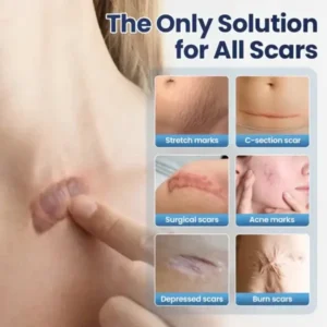 TAILEDEN® Texture Repair Gel