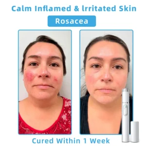 𝐓o𝐭a𝐥 𝐒𝐤𝐢𝐧 𝐂𝐨𝐧𝐟𝐢𝐝𝐞𝐧𝐜𝐞 𝐒𝐭𝐚𝐫𝐭𝐬 𝐇𝐞𝐫𝐞💎NESLEMY® 𝗡𝗼𝗻-𝗜𝗻𝘃𝗮𝘀𝗶𝘃𝗲 𝗠𝗼𝗜𝗲 𝗮𝗻𝗱 𝗪𝗮𝗿𝘁 𝗥𝗲𝗺𝗼𝘃𝗮𝗜 𝗜𝗮𝘀𝗲𝗿 𝗣𝗲𝗻