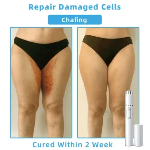 𝐓o𝐭a𝐥 𝐒𝐤𝐢𝐧 𝐂𝐨𝐧𝐟𝐢𝐝𝐞𝐧𝐜𝐞 𝐒𝐭𝐚𝐫𝐭𝐬 𝐇𝐞𝐫𝐞💎NESLEMY® 𝗡𝗼𝗻-𝗜𝗻𝘃𝗮𝘀𝗶𝘃𝗲 𝗠𝗼𝗜𝗲 𝗮𝗻𝗱 𝗪𝗮𝗿𝘁 𝗥𝗲𝗺𝗼𝘃𝗮𝗜 𝗜𝗮𝘀𝗲𝗿 𝗣𝗲𝗻