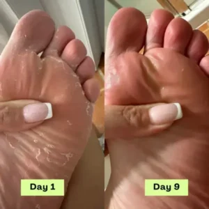 55% off NESLEMY® AntiFungal Relief Soap Bar