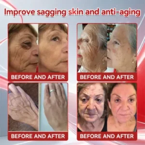 Croaie®GLP-1+Collagen Peptides Weight Loss&Firming Oral Solution