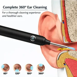 ⏳Limited Time 70% Discount💥NESLEMY™ Intelligent Waterproof Visual Earwax Remover