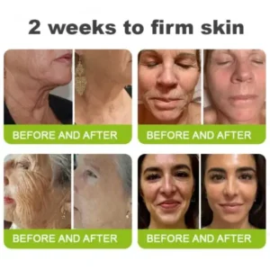 Made in the USA direct shipping Botox Vitamin A Retinol Anti-Wrinkle Firming and Lifting Cream