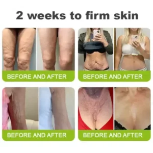 Made in the USA direct shipping Botox Vitamin A Retinol Anti-Wrinkle Firming and Lifting Cream