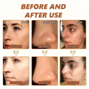 NESLEMY™ Whitening and Spot-Removing Face Mask Suitable for face and body