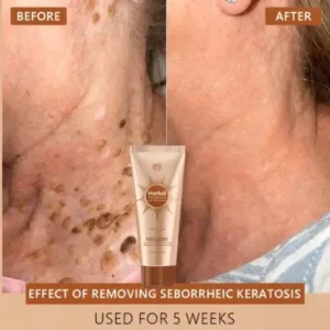 NESLEMY™ Whitening and Spot-Removing Face Mask Suitable for face and body