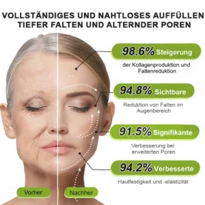 Now regain youthful skin. 💫👨‍⚕️ NESLEMY ™ Botox & Vita-A Retinol Shot Wrinkle Lift Firming Cream