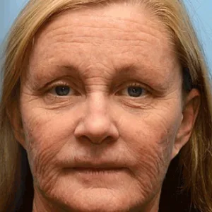 QIAWI™ Botulinum & Vita-A Retinol Shot Wrinkle-Lift Tightening cream