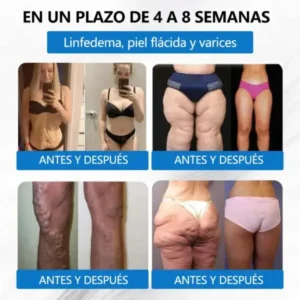 Valentine’s Day Special ⭐ Risarisa® 7-in-1 Patch for Weight & Cravings Control