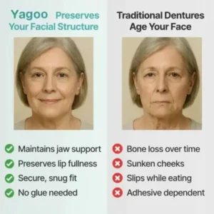 Yagoo® – Medical Full Denture with Strong Suctiond