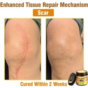 Ealthsn™ Botulinum Toxin & BEE Venom Pain-Relief Bone Healing Cream