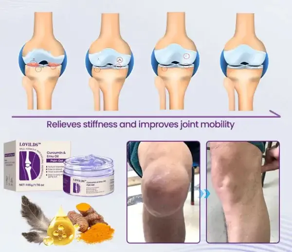 (🔥LAST DAY SALE – 80% OFF) Curcumin & Emu Oil Pain Gel – 🏥Backed by US Osteopathic Experts