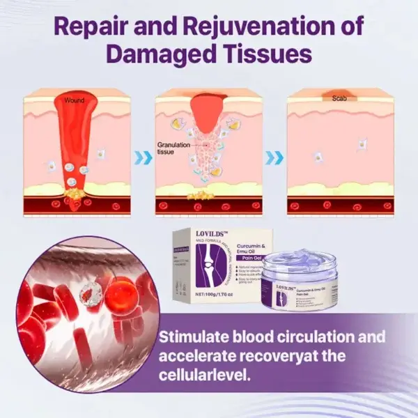 (🔥LAST DAY SALE – 80% OFF) Curcumin & Emu Oil Pain Gel – 🏥Backed by US Osteopathic Experts