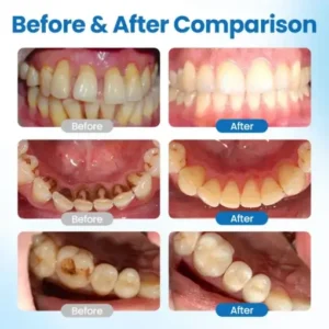 NESLEMY™ NanoHAP Tooth Defense Serum