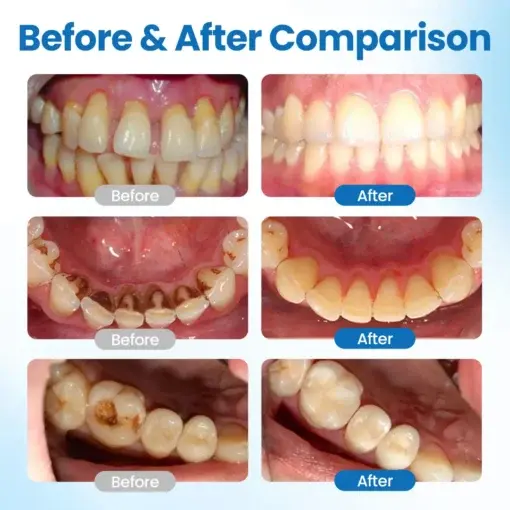 NESLEMY™ NanoHAP Tooth Defense Serum