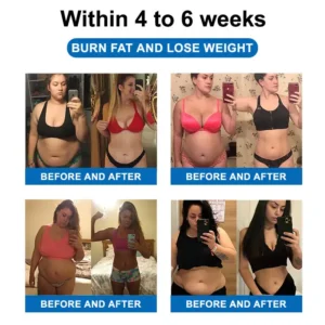 🧑‍⚕️NESLEMY™ Ultrasonic Fat Blasting and Detoxing Wristband B