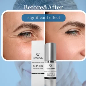 NESLEMY™ Age-Reverse Serum | Look younger in just 48 hours – visibly smoother, firmer, more radiant!