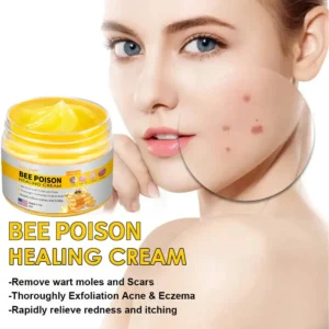 NESLEMY™ Bee Poison Skin Cream(👨⚕AAD Recommended),for Remove Warts, Acne and Scars