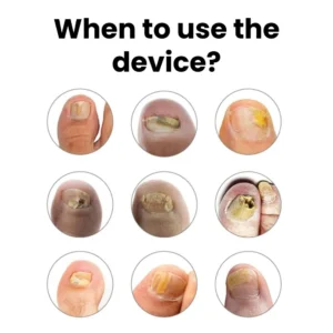 NESLEMY™ ClearNail Blue Light Device