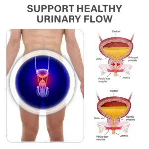 NESLEMY™ ProstateFlow RF Therapy Band