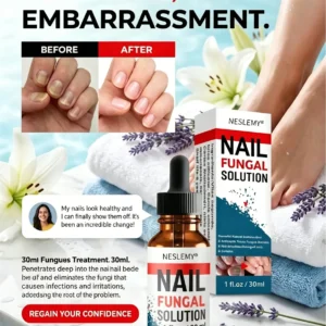 Nail Fungus – NESLEMY® Advanced Antifungal Nail Drops (30 ml)