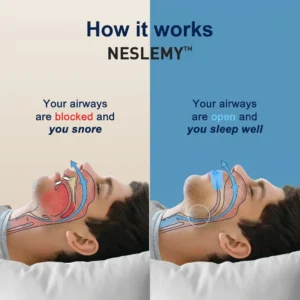 Neslemy Pro - Intelligent Snoring Device