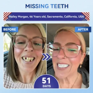 Your Smile~ NESLEMY® 🦷 Tideglusib Fast‑Dissolving Tooth & Gum Repair Oral Strips ✨ (𝟓-𝐢𝐧-𝟏 💎 𝐑𝐞𝐛𝐮𝐢𝐥𝐝 𝐄𝐧𝐚𝐦𝐞𝐥 & 𝐃𝐞𝐧𝐭𝐢𝐧 • 𝐒𝐭𝐫𝐞𝐧𝐠𝐭𝐡𝐞𝐧 𝐆𝐮𝐦𝐬 • 𝐄𝐫𝐚𝐝𝐢𝐜𝐚𝐭𝐞 𝐓𝐚𝐫𝐭𝐚𝐫 & 𝐎𝐝𝐨𝐫 • 𝐖𝐡𝐢𝐭𝐞𝐧𝐢𝐧𝐠 • 𝐒𝐭𝐨𝐩 𝐓𝐨𝐨𝐭𝐡 𝐒𝐞𝐧𝐬𝐢𝐭𝐢𝐯𝐢𝐭𝐲)