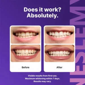 NESLEMY™🦷Purple Whitening Strips💥