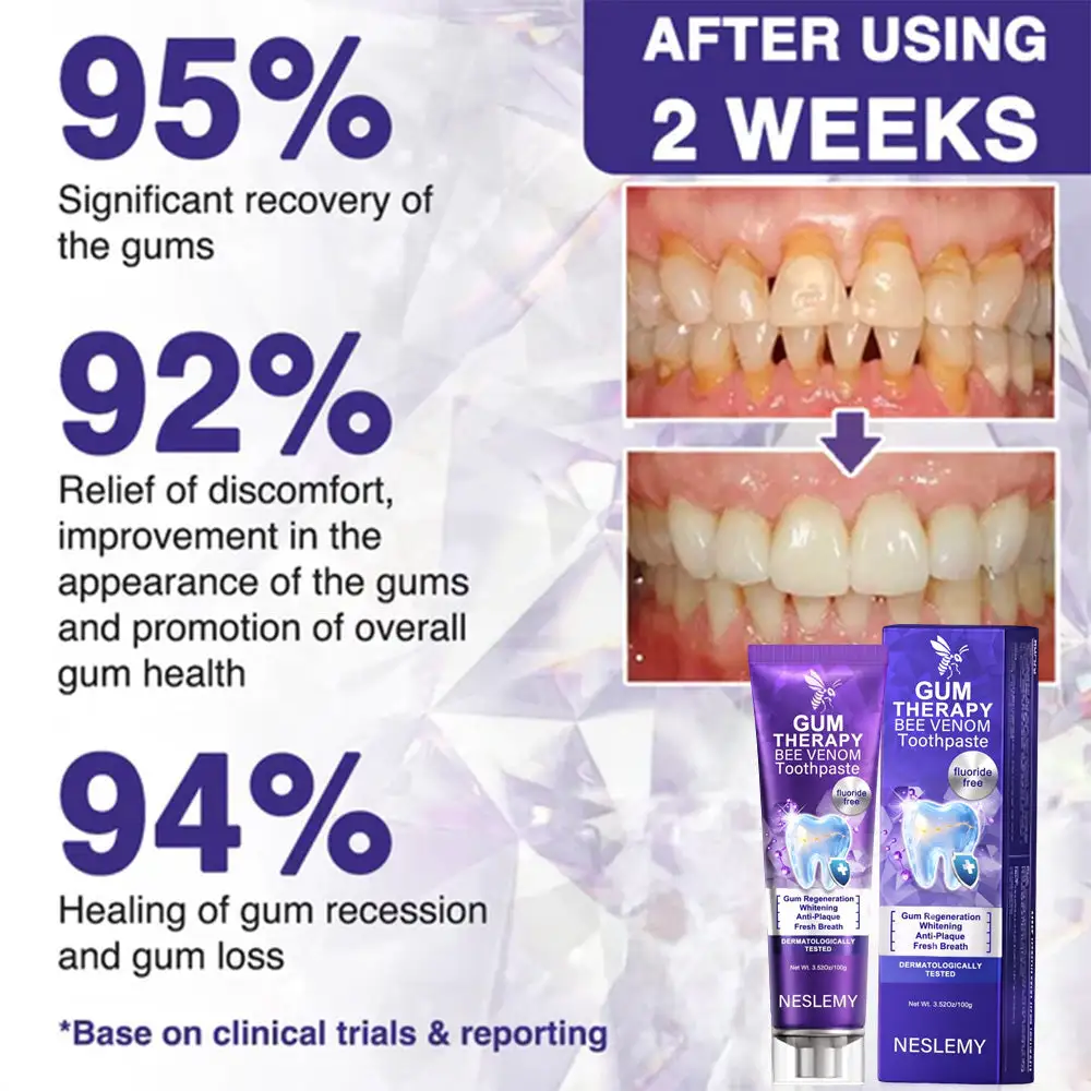 🔥Last Day 80% OFF 👨⚕️ NESLEMY® Bee Venom Dental Treatment Toothpaste