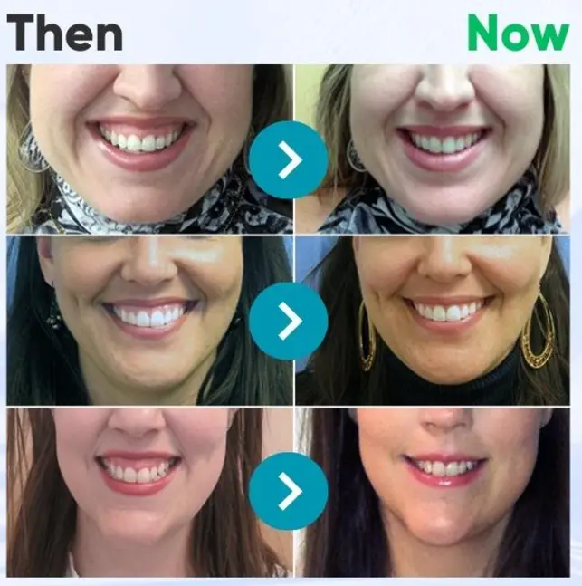 🔥Last Day 80% OFF 👨⚕️ NESLEMY® Bee Venom Dental Treatment Toothpaste