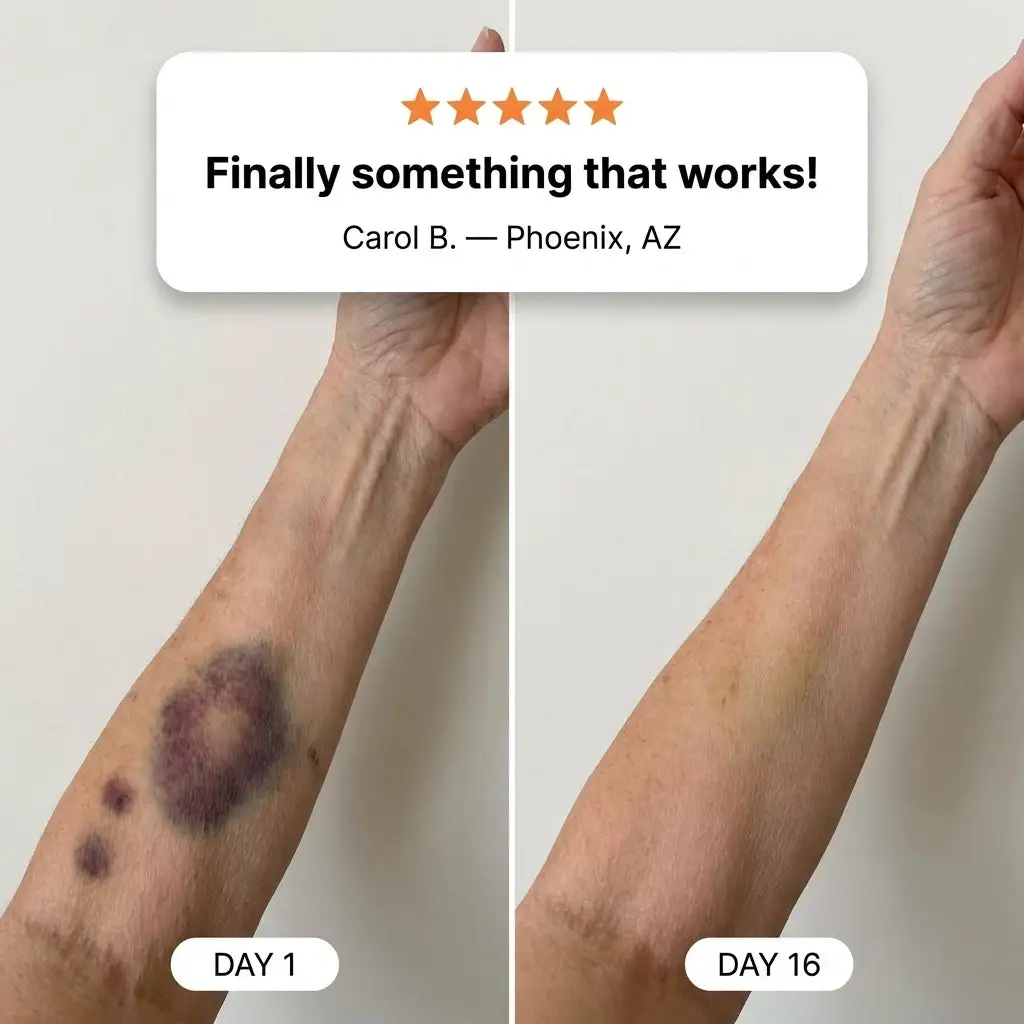 💥300K+ SOLD💕- NESLEMY® Bruise Repair & Skin-Strengthening Cream