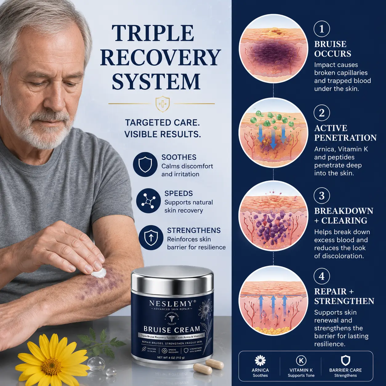 💥300K+ SOLD💕- NESLEMY® Bruise Repair & Skin-Strengthening Cream